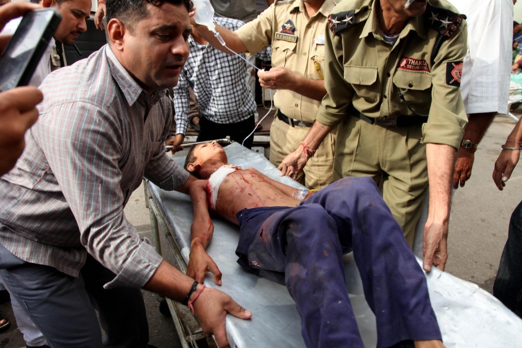 A youth is taken to a medical facility on the Indian side. Photo: AFP