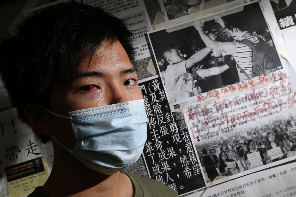 "Alex" said he was temporarily blinded after a policeman pulled up his face mask on Wednesday and shot a blast of pepper spray directly into his face. Photo: K.Y.Cheng