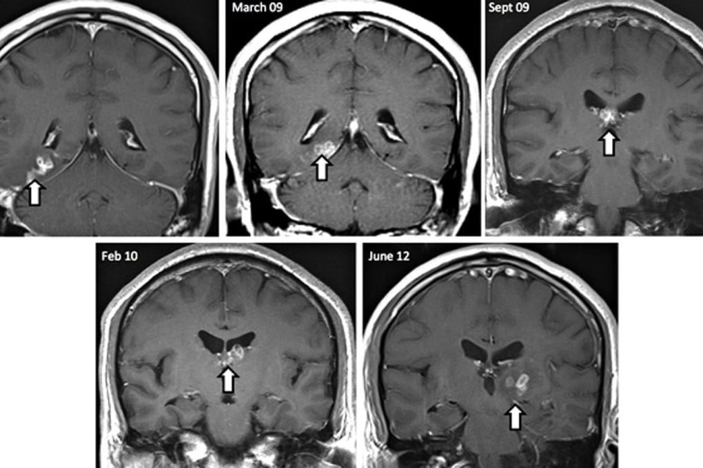 Time-lapse scans show the worm's movements. Photo: National Picures