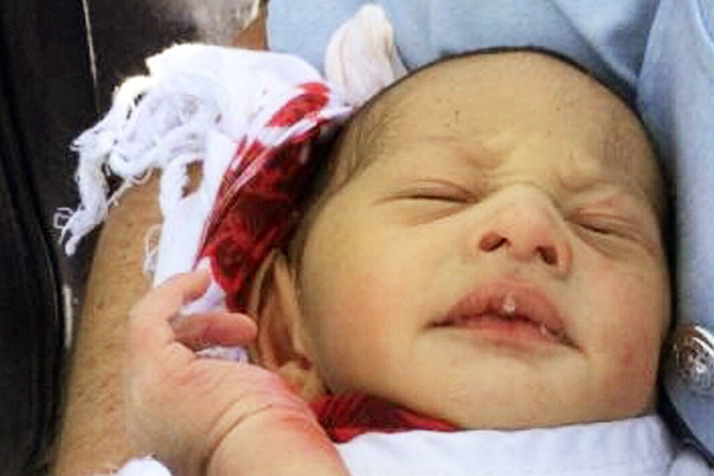 The newborn baby was found after up to five days in a drain. Doctors said he could not have survived much longer. Photo: AP