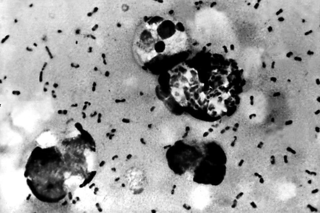 An US Centers For Disease Control image of the bubonic plague bacteria. Photo: AFP
