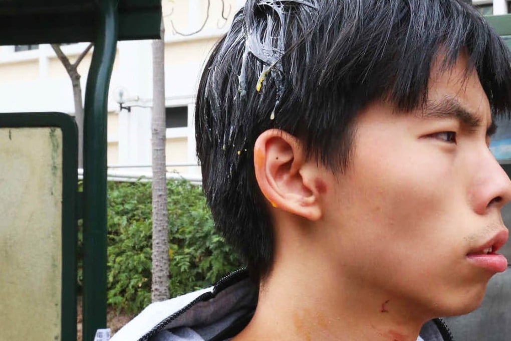 Joshua Wong had eggs thrown at him by two men outside Kowloon City Court. Photo: K. Y. Cheng