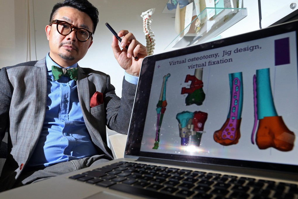 Dr Liu King-lok says 3D printing technology has the potential to improve results in more kinds of bone surgery. Photo: K.Y. Cheng