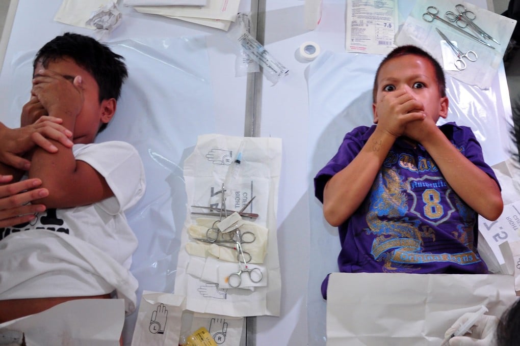 Children participate in a mass circumcision. A boy in Turkey suffered mutilations when he was a year old due to inexpert circumcision. Photo: EPA
