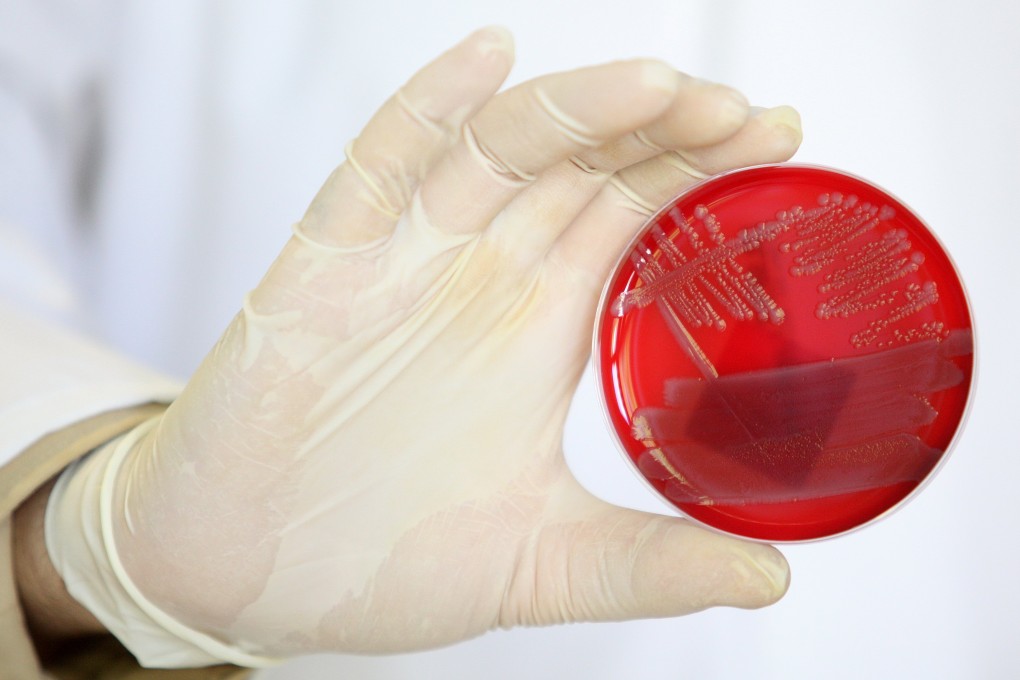 A scientist holds up a petri dish covered in a bloom of the E coli microbe. Genetically altered versions of the same bug have been created that cannot survive without artificial compounds. Photo: AFP