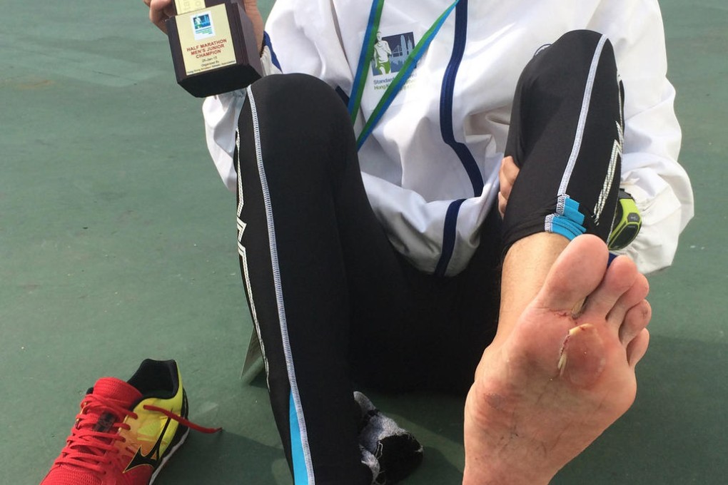 Alex Chan Wai-tung with his spoils of victory. Photo: Nora Tam