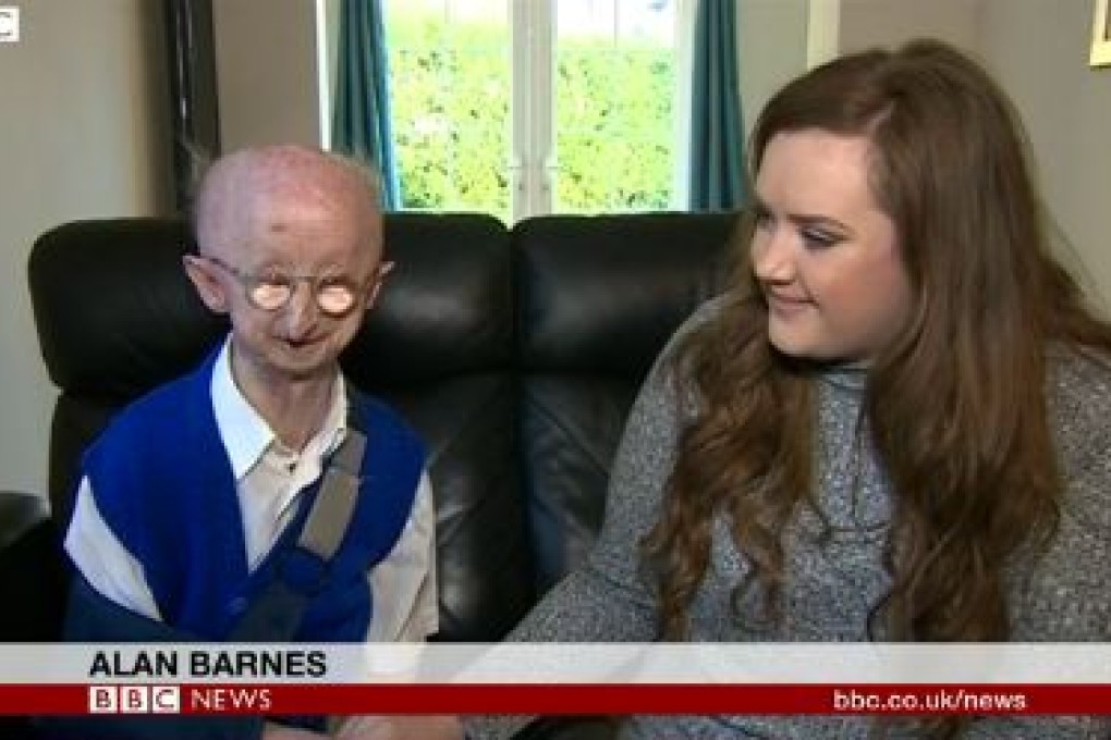 Alan Barnes and Katie Cutler, being interviewed together by the BBC. Cutler had hoped to raise GBP500 for Barnes, a local identity in Gateshead, after he was mugged. She ended up receiving more than GBP220,000. Photo: BBC