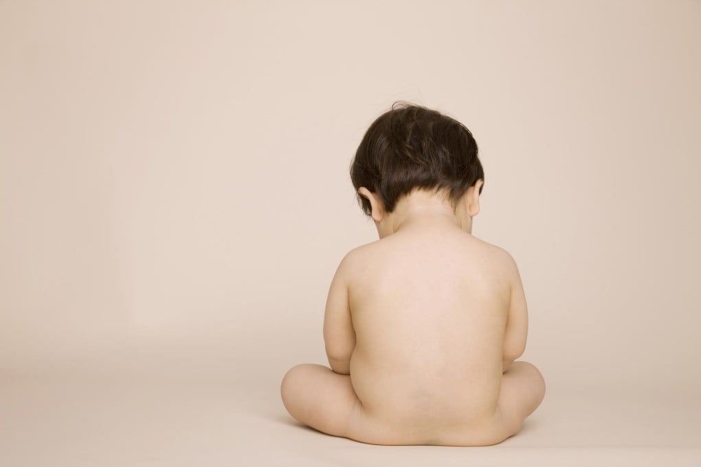 Babies' brown fat diminishes quickly in infancy.