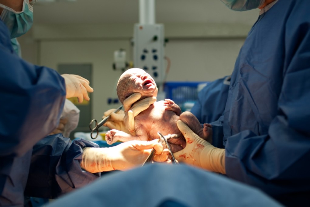 For health's sake, make caesarean sections the last resort