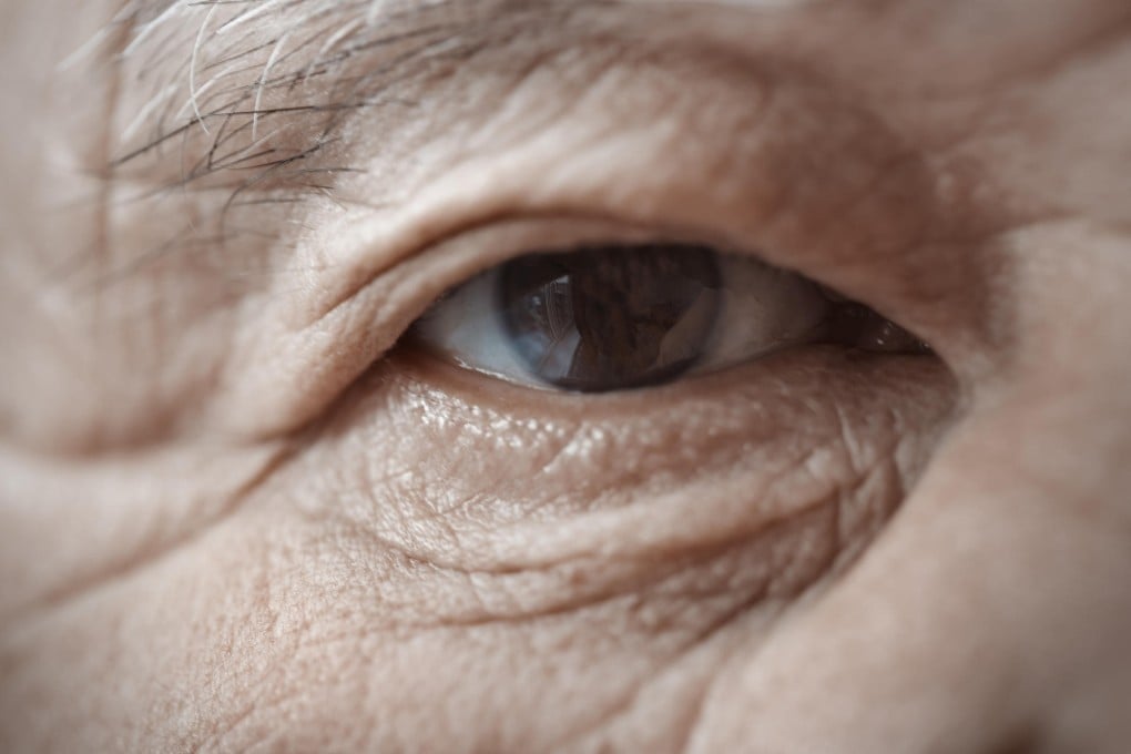 Early detection and treatment of AMD is important.