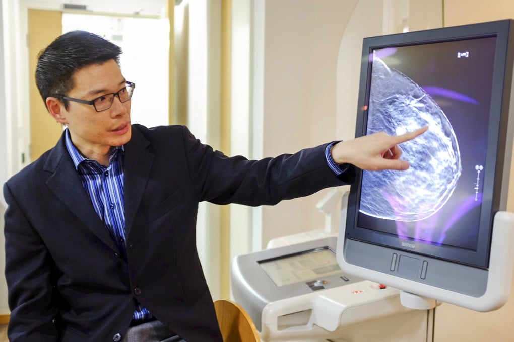 Dr Hung Wai-ka, honorary medical advisor at the Hong Kong Breast Cancer Foundation's Breast Health Centre, shows what a 3D image of the breast using tomosynthesis (3D mammography) looks like on a screen. Photo: Jeanette Wang