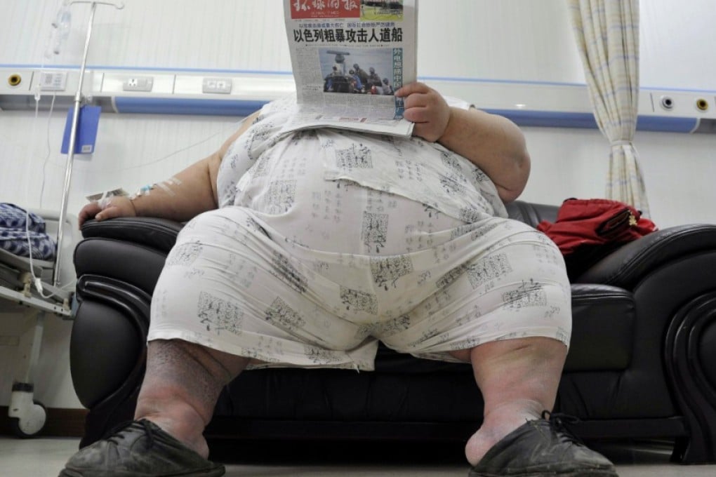 New study finds subjects imagined unpleasant smells when shown photos of obese people