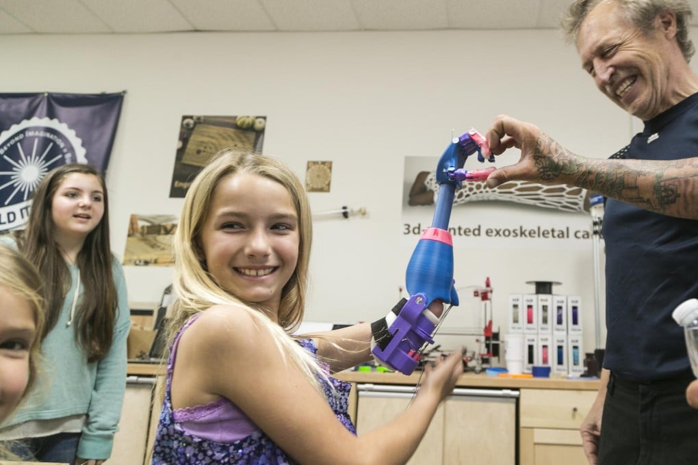 Faith Lennox with her new US$50 3D-printed hand, which replaces the limb lost to compartment syndrome suffered at birth.Photo: AP