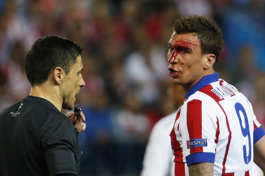 Atletico Madrid's Mario Mandzukic remonstrates with referee Milorad Mazic as he walks off the pitch to receive treatment after sustaining a head injury. Photo: Reuters