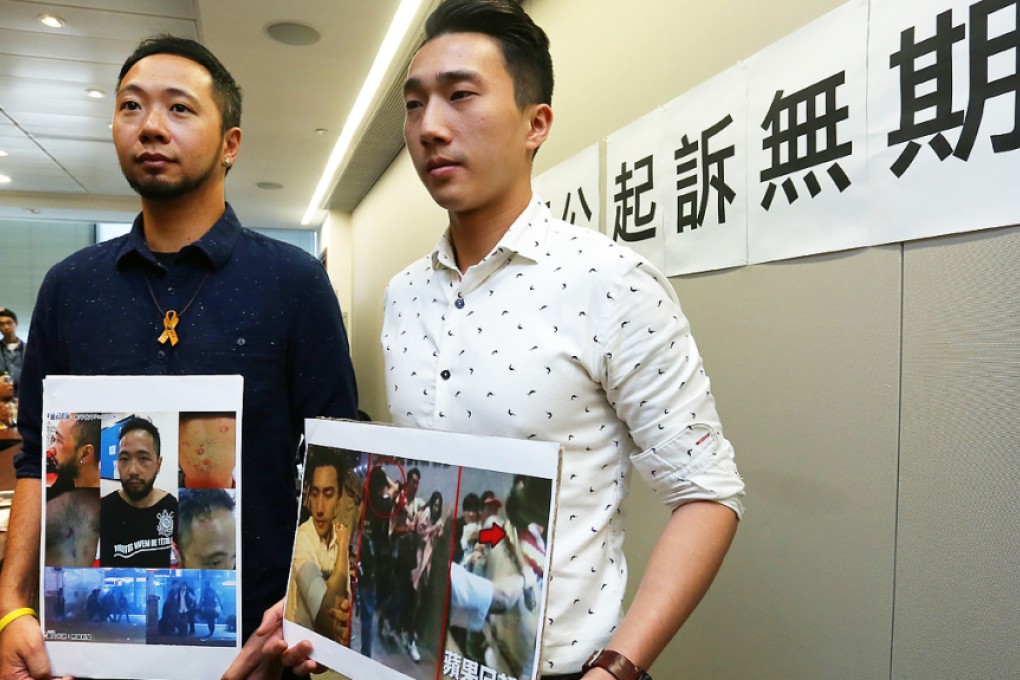 Civic Party's Ken Tsang Kin-chiu (left, who got beaten by seven police officers in Tamar Park in 2014) and Osman Cheng Chung-hang (who got beaten by a police officer in 2014 in Mong Kok) at a press conference in Legco Complex on April 15. Photo: Jonathan Wong