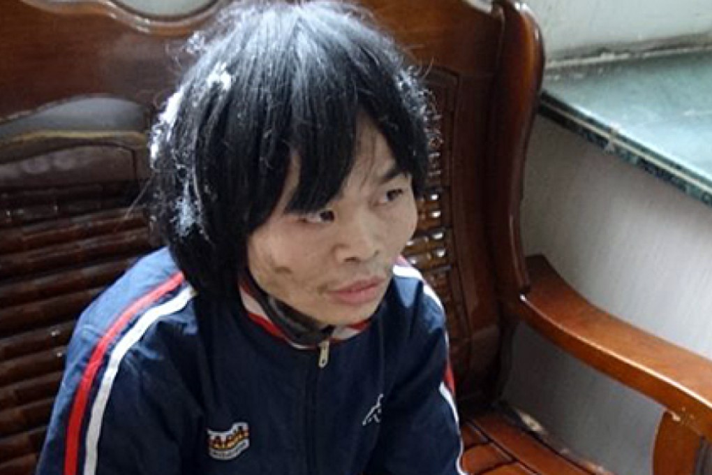 Xie Shisheng is pictured on Wednesday after his rescue by police after being held prisoner for 18 years. Photo: Qingyuan Daily