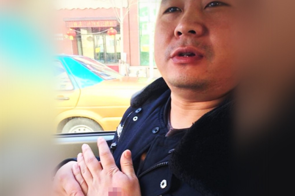 The unidentified policeman nurses his injured hand. Photo: SCMP Pictures