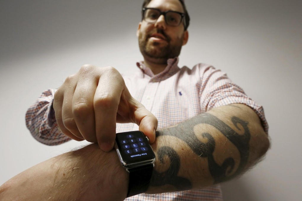 Matt Siegel's tattoos confuse his new Apple Watch. Photo: Reuters