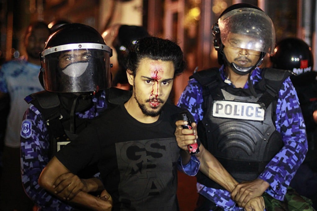 Police detain injured opposition protester in Male. Photo: AP