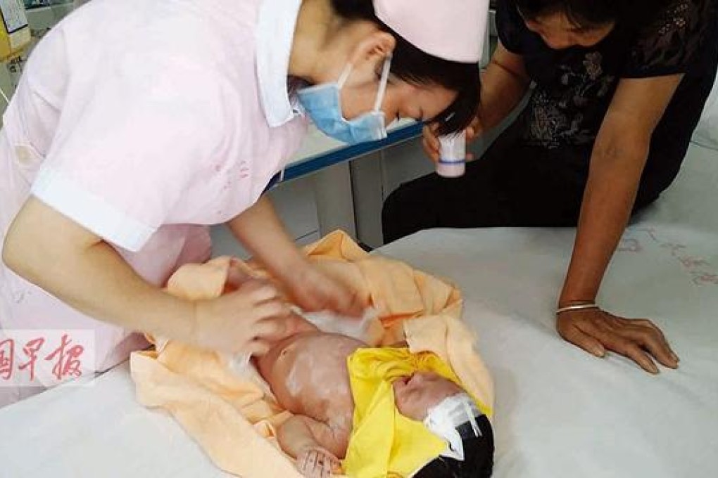 The baby receiving care in hospital. He was found in a cardboard box under several centimetres of earth. Photo: Southcn.com