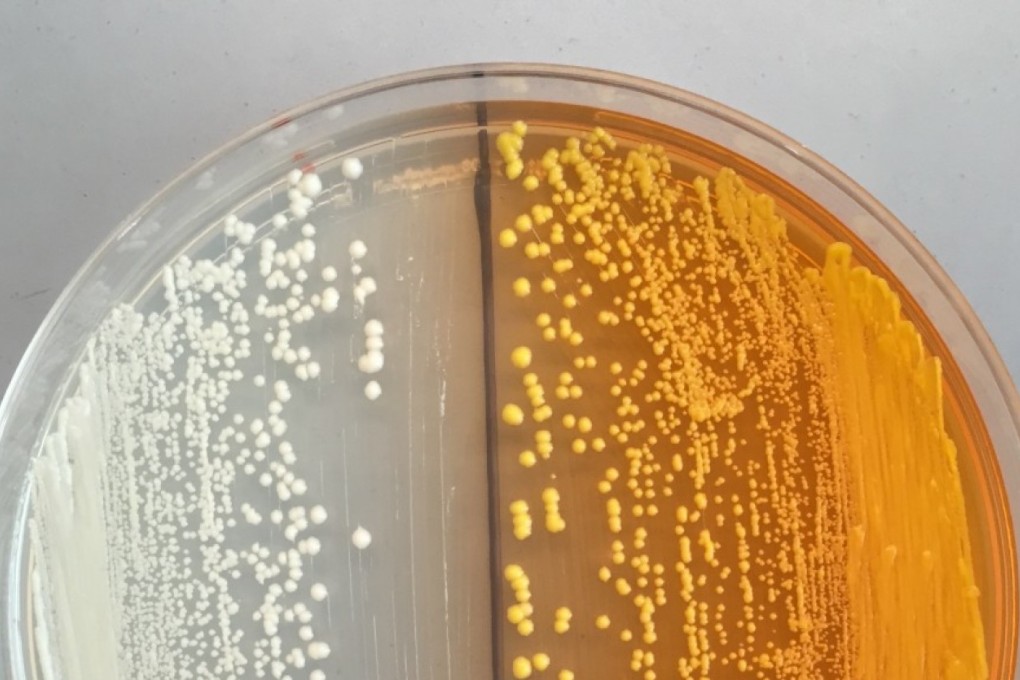 Genetically modified yeast like this can form the basis for laboratory-grown opiates. Photo: Washington Post
