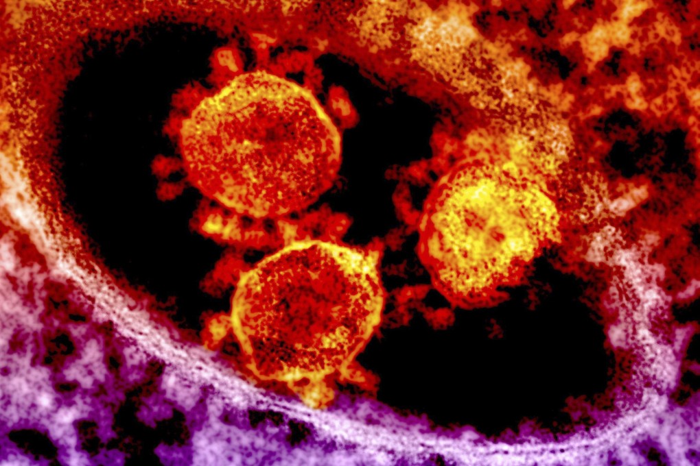 Particles of the Middle East respiratory syndrome (Mers) coronavirus that emerged in 2012 are seen in an undated colorised transmission electron micrograph. Photo: Reuters