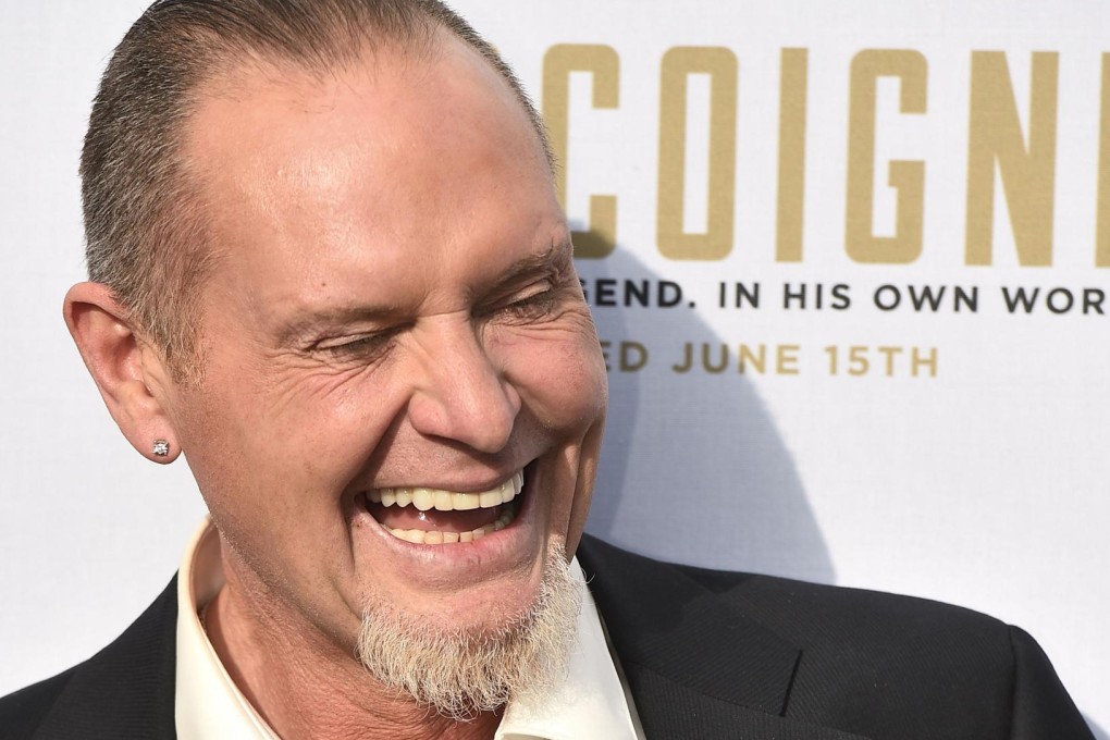 Former England star Paul Gascoigne is cashing in on his misfortunes. Photos: AFP, AP, Reuters