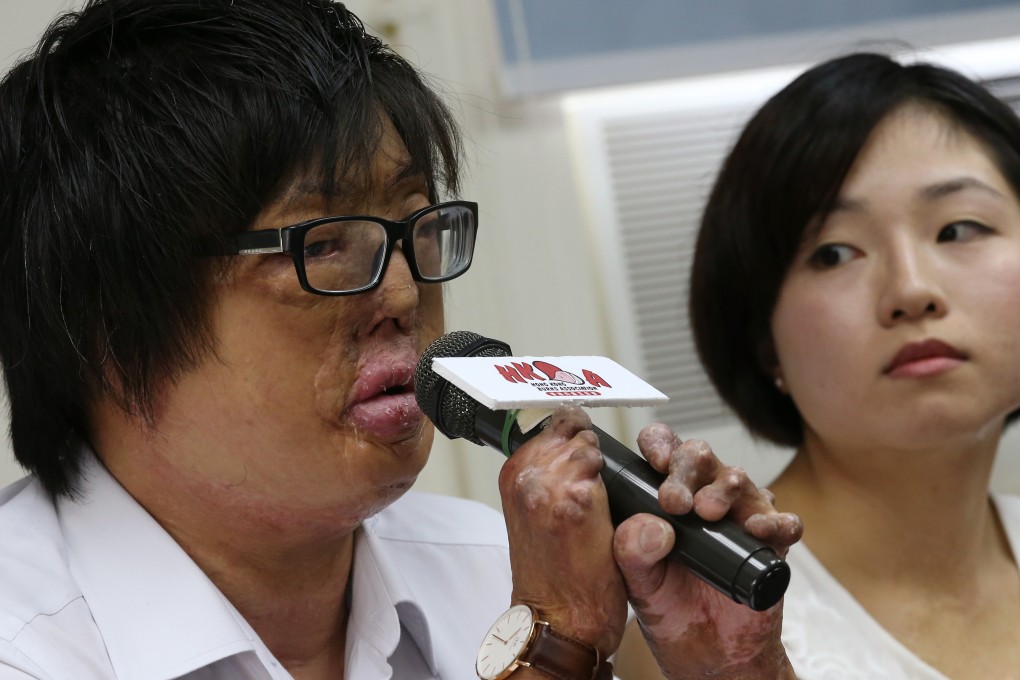 Stanley Cheung Yun-hangn (left) meeting press today. He was himself badly burned in a Hong Kong fire in 1996 that claimed the lives of five others. Photo: Dickson Lee