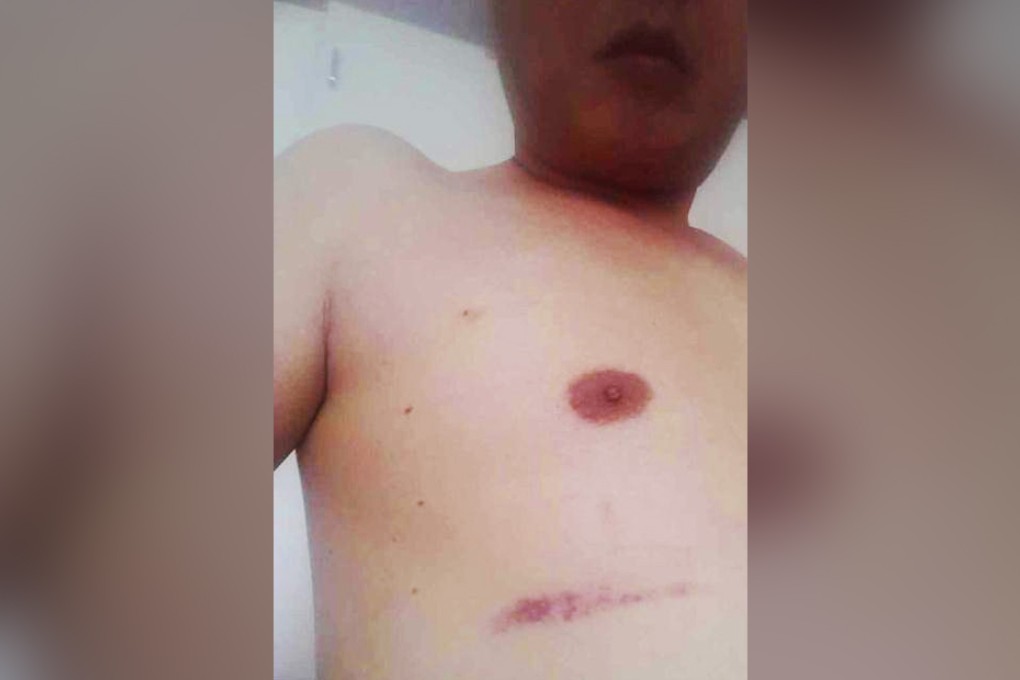 The victim, named Chen, shows one of the injuries he received at the police station. Photo: Sohu.com