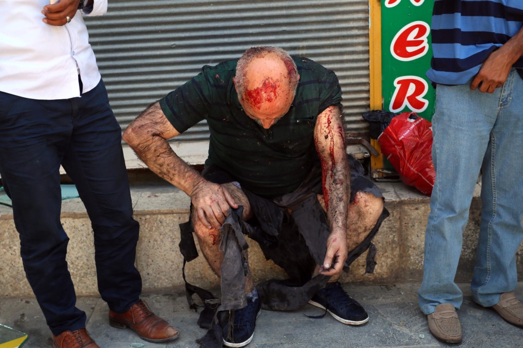 A man wounded in the explosion in Suruc awaits attention. Photo: AP