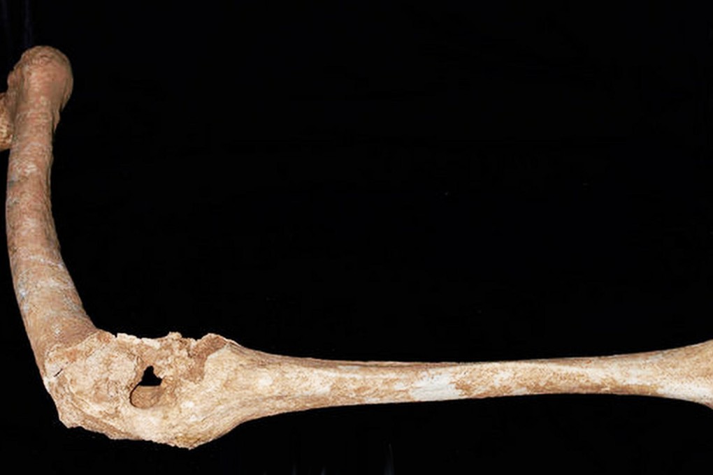 This bone is probably the left leg of King Philip II of Macedon (below). Photo: SCMP Pictures