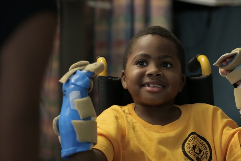 Eight-year-old Zion Harvey's wish to someday throw a football is expected to be realised soon with his new hands and forearms. Photo: Children's Hospital of Philadelphia