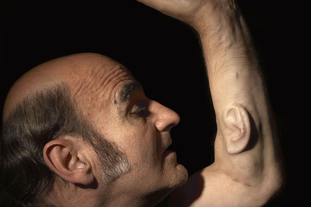 Professor Stelarc reveals the ear on his arm. Photos: AFP and SMP Pictures