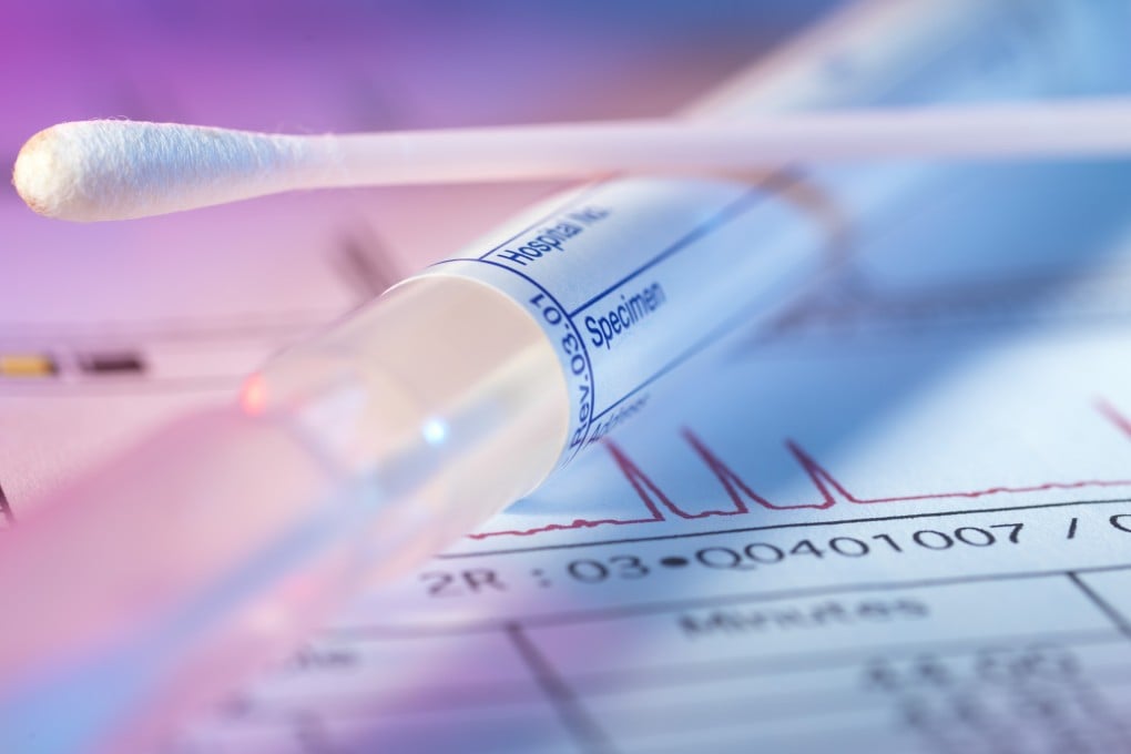 DNA swab tests could identity possible hereditary problems