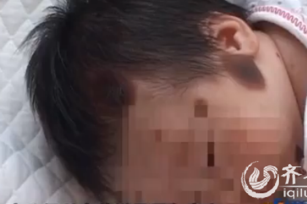 The abandoned baby was found by an elderly man in a park. Photo: Iqilu.com