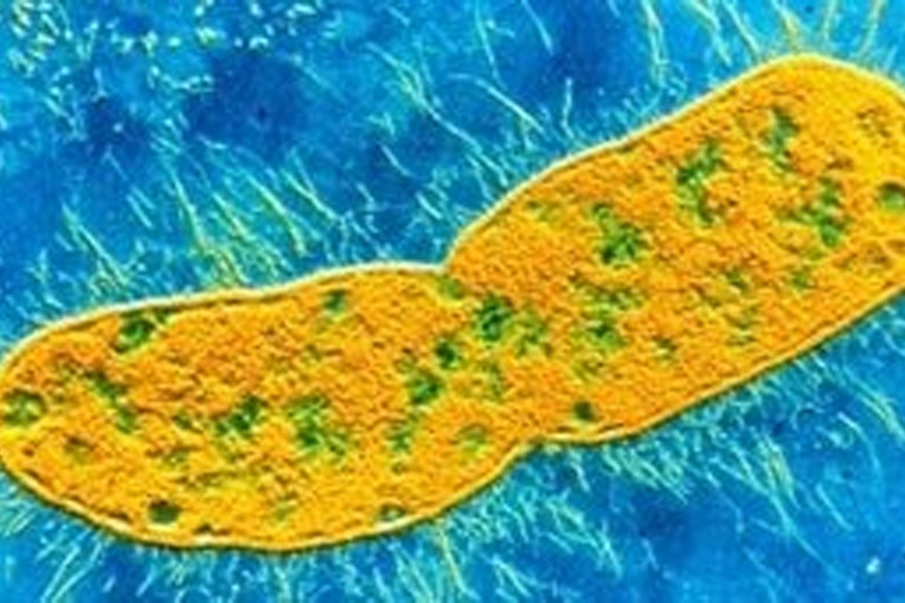 Superbugs are resistant to antibiotics but research in China could help drugs penetrate the membrane of bacteria. Photo: SCMP Pictures