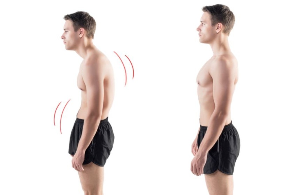 Mom Was Right. Proper Posture Is Important To Health