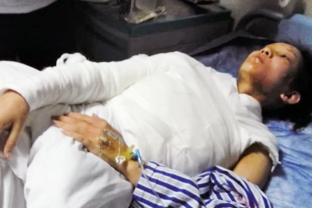 The woman suffered burns to 40 per cent of her body. Photo: Wenzhou Metropolis News