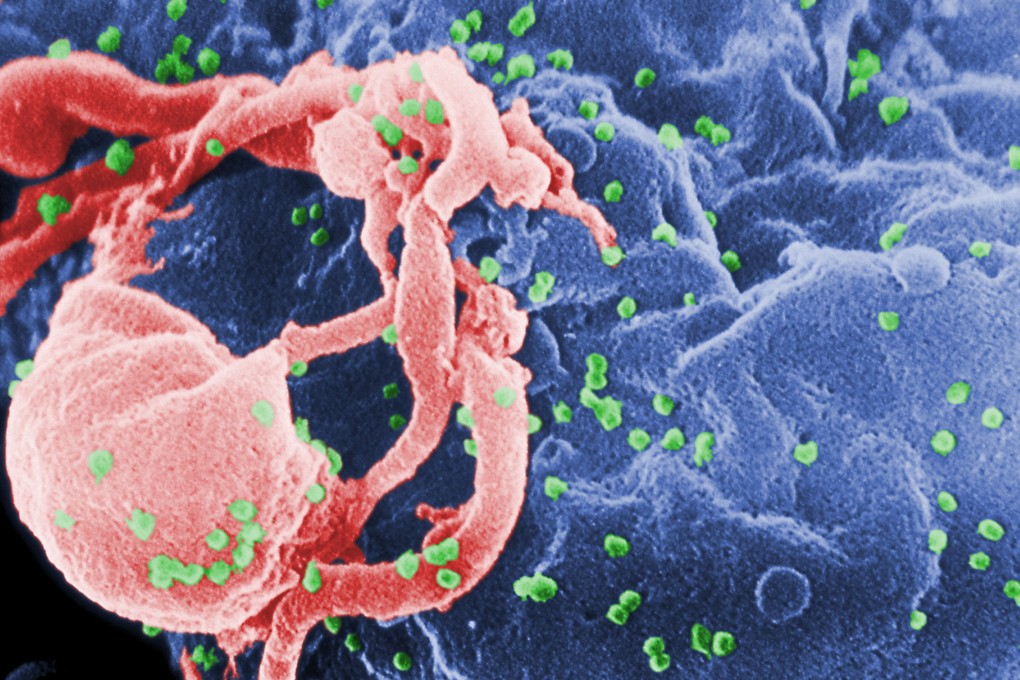 HIV, or the human immunodeficiency virus, attacks the immune system, making it harder for the body to fight infections.