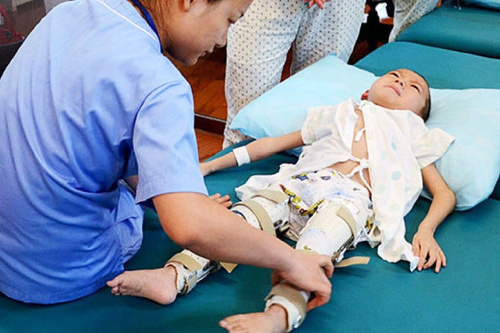 A six-year-old boy from China's Guizhou province was able to walk again after a groundbreaking surgery using 3D-printing technology. Photo: SCMP Pictures