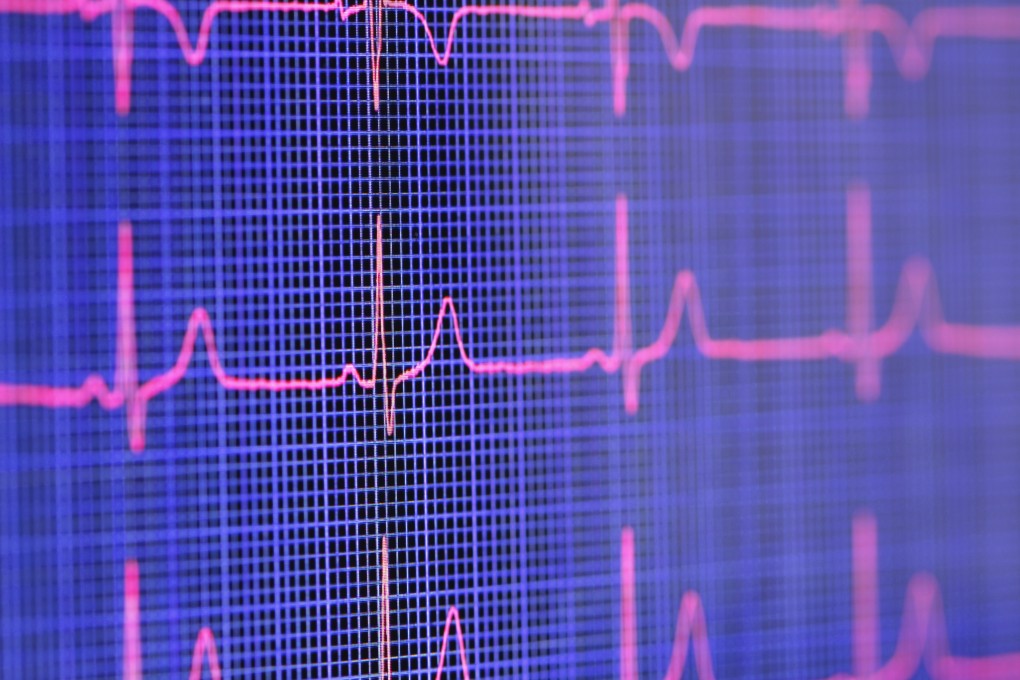Hongkongers are now able to download MyHeart Counts and take part in a global study of cardiovascular health. Photo: Corbis