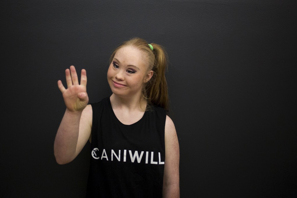 18-year-old model with Down'S syndrome, Madeline Stuart poses for a photo at a designer fitting and casting event at King's College in Manhattan. Photo: Reuters