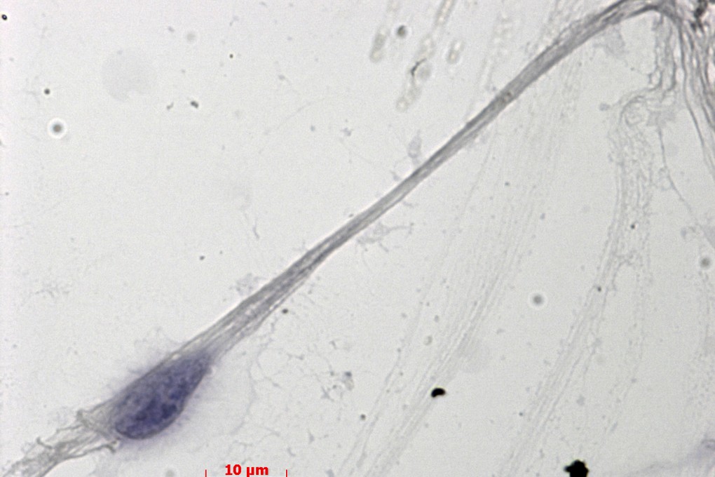 A photo provided by French government lab CNRS that is said to show one of the lab-grown sperm cells. Photo: AP