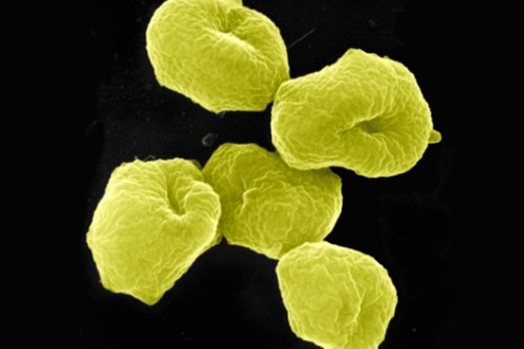 The Chinese team took Haloferax mediterranei as their study subject, a species of archaea (single-celled microorganisms, pictured) that may have formed the first life on the planet around 4 billion years ago. Photo: SCMP Pictures