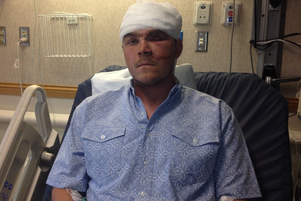 Dellwo received stitches and staples in his head, some on his face, a swollen eye and deep puncture wounds on his leg. Photo: AP