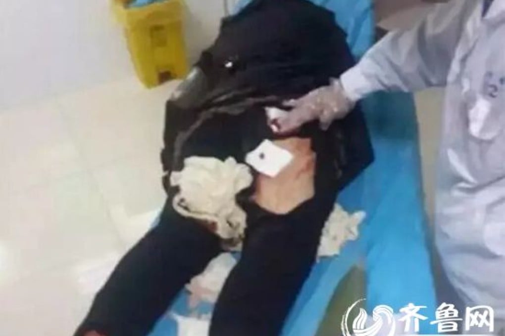 One of the stabbing victims in Yantai in Shandong province. Photo: Iqilu.com