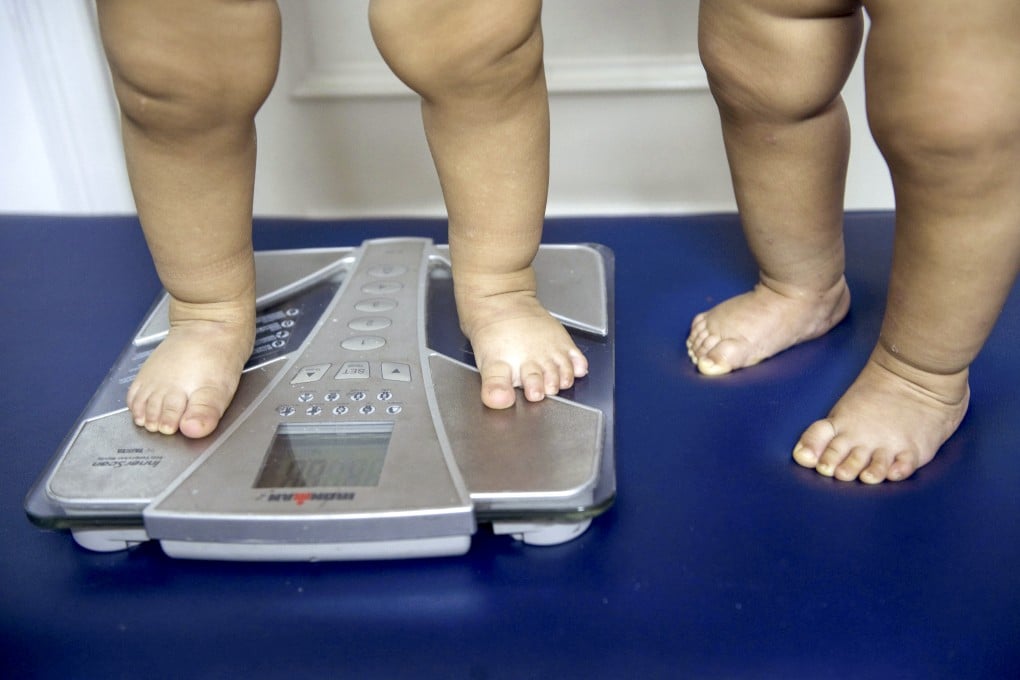 Processed, sugary and fried foods all contribute to obesity in kids. Photo: AFP