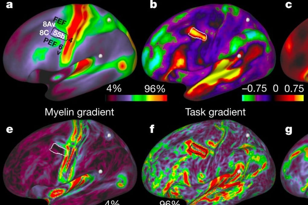 The newly published map divides the brain up into 180 unique brain regions, of which 97 have never been identified before. Photo: Nature Neuroscience