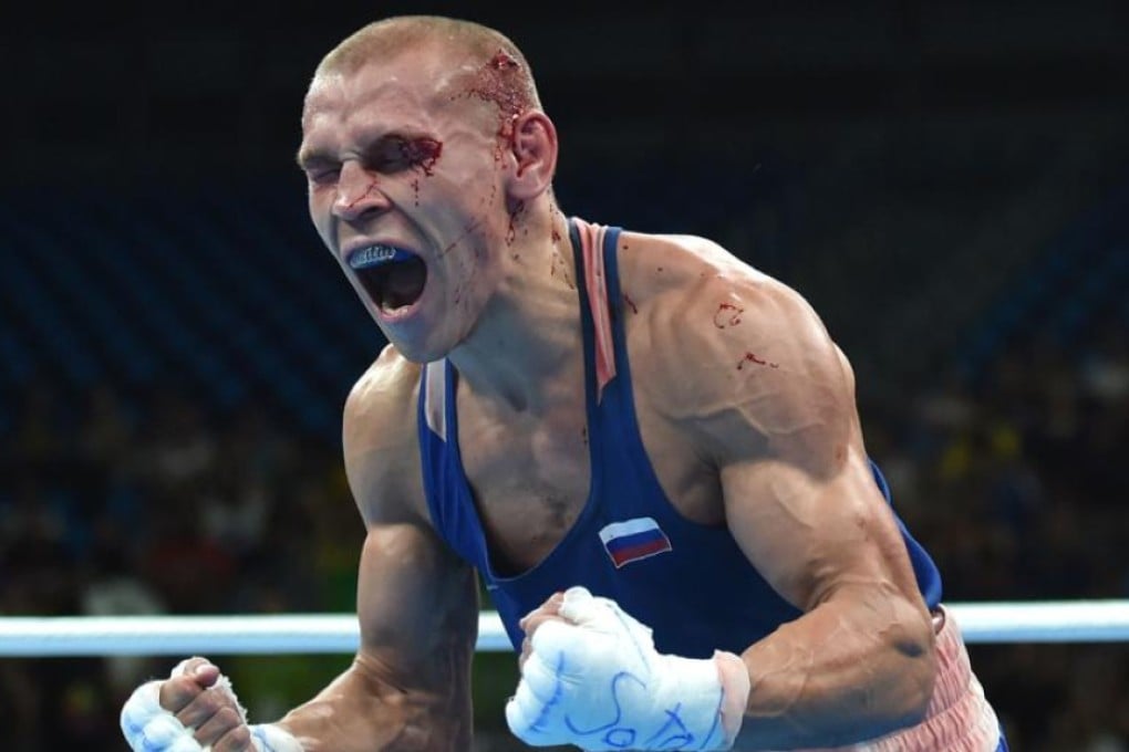 Blood-covered Russian Vladimir Nikitin reacts to his surprise win over Ireland’s Michael Conlan during the men’s bantam quarter-final in Rio on Tuesday. Photo: AFP