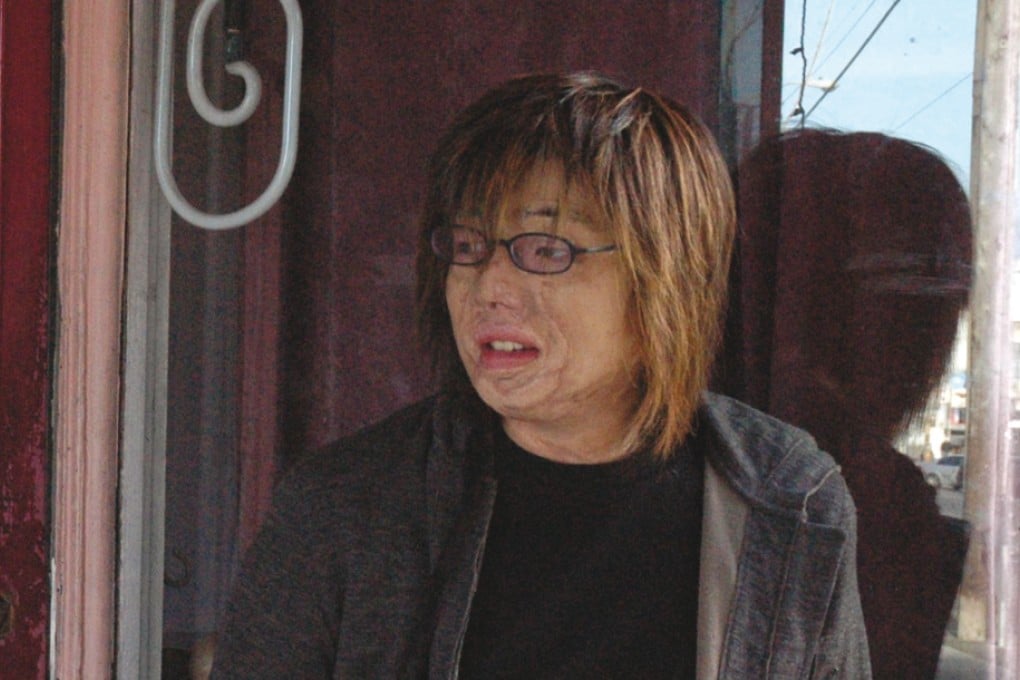 Pat Sin Leng Hill Fire Survivor Stanley Cheung Yun-Hang